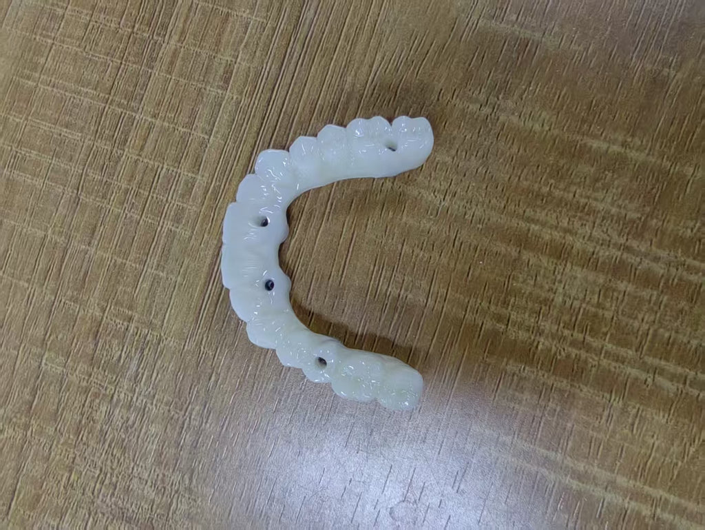 PMMA Bridge With Ti-Base Screw Retained Trying For Full Arch Restoration