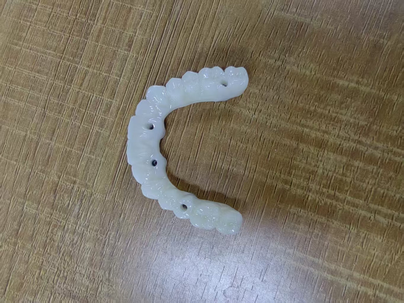 PMMA Bridge With Ti-Base Screw Retained Trying For Full Arch Restoration