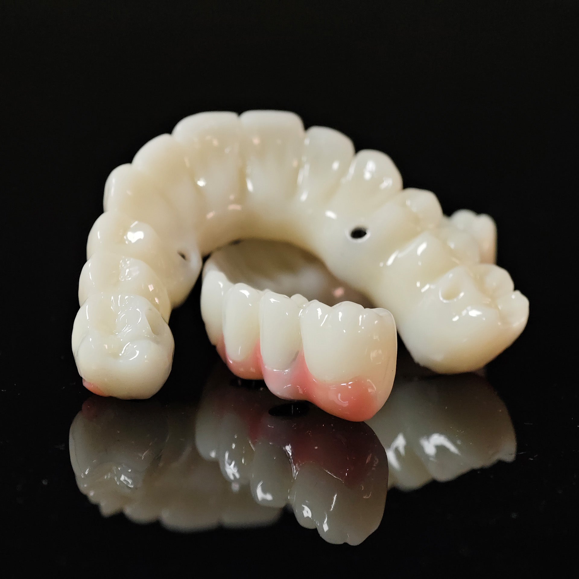 PMMA Bridge With Ti-Base Screw Retained Trying For Full Arch Restoration