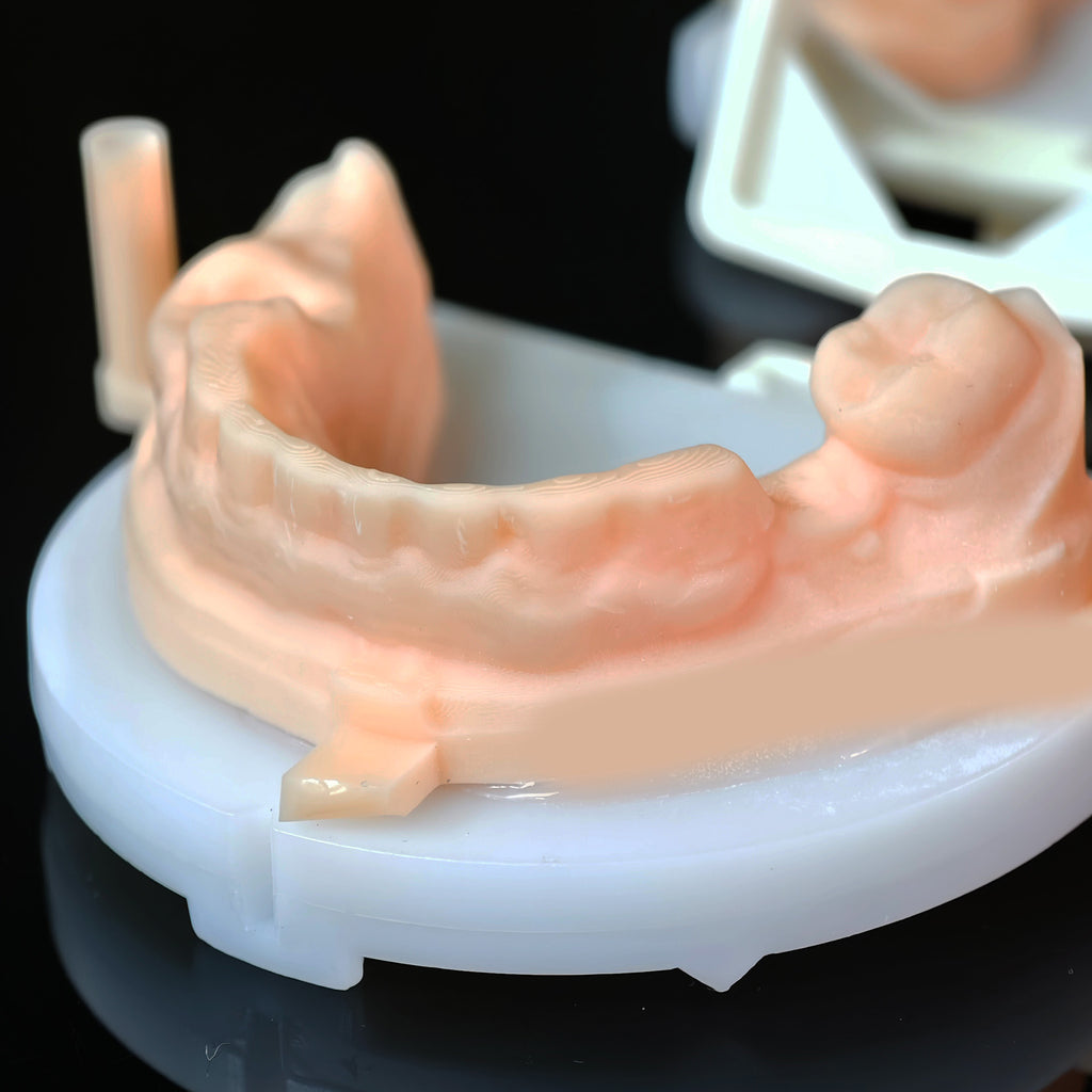 PMMA Bridge With Open Shell Preparing For Full Arch Dental Implants