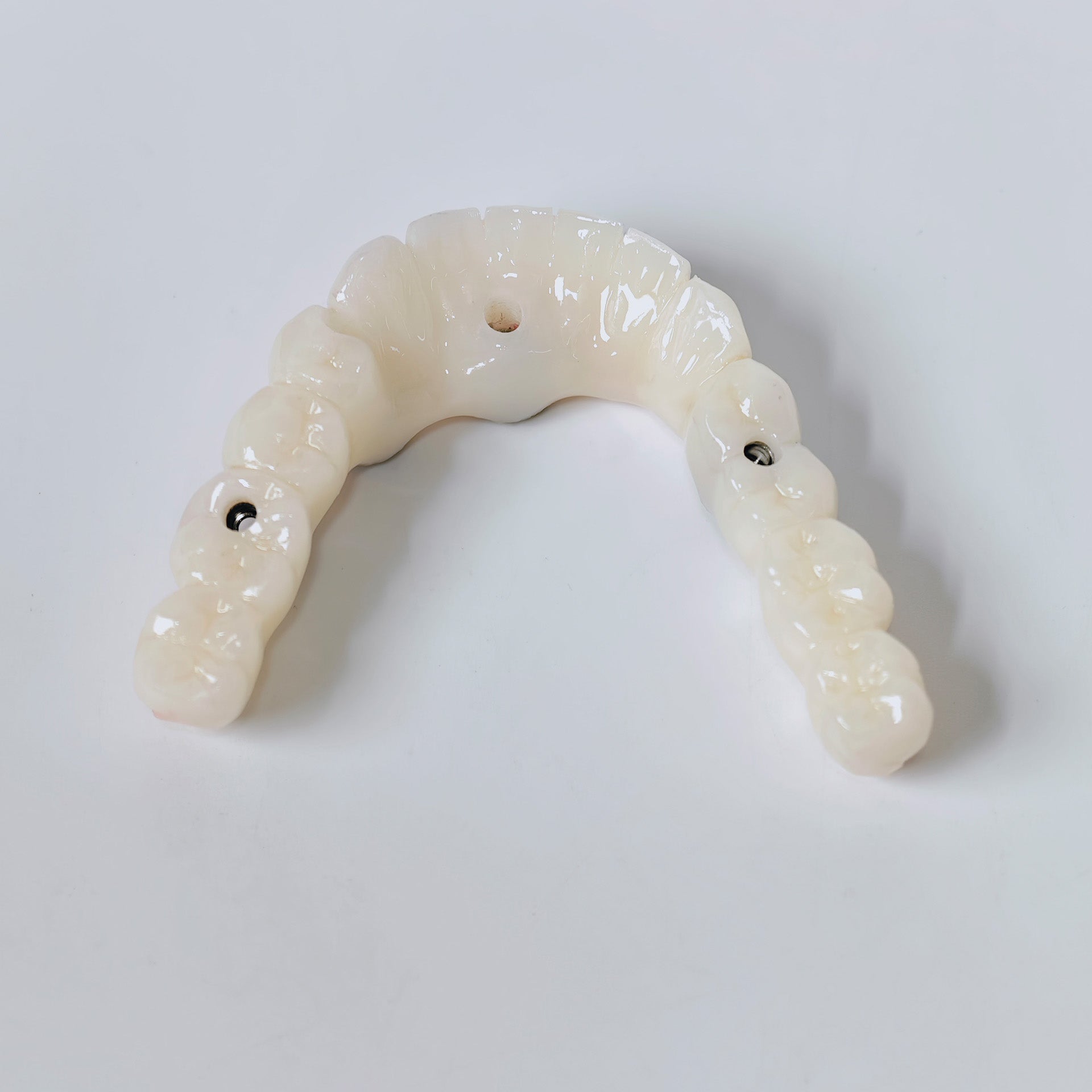 PMMA Bridge With Screw Retained
