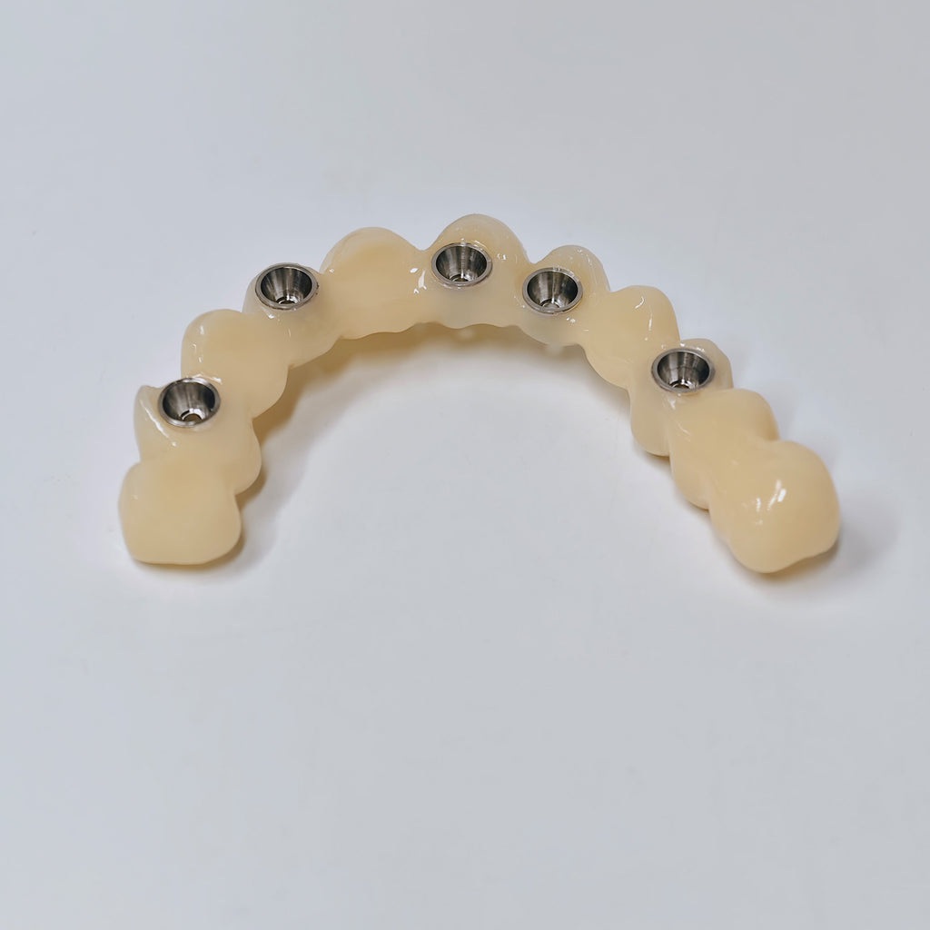 PMMA Bridge With Screw Retained