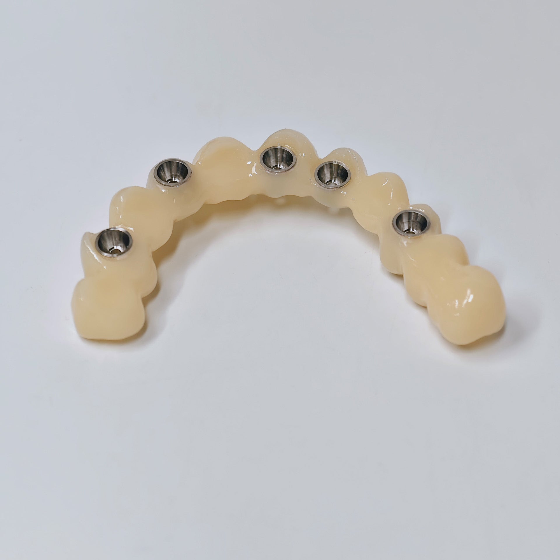 PMMA Bridge With Screw Retained