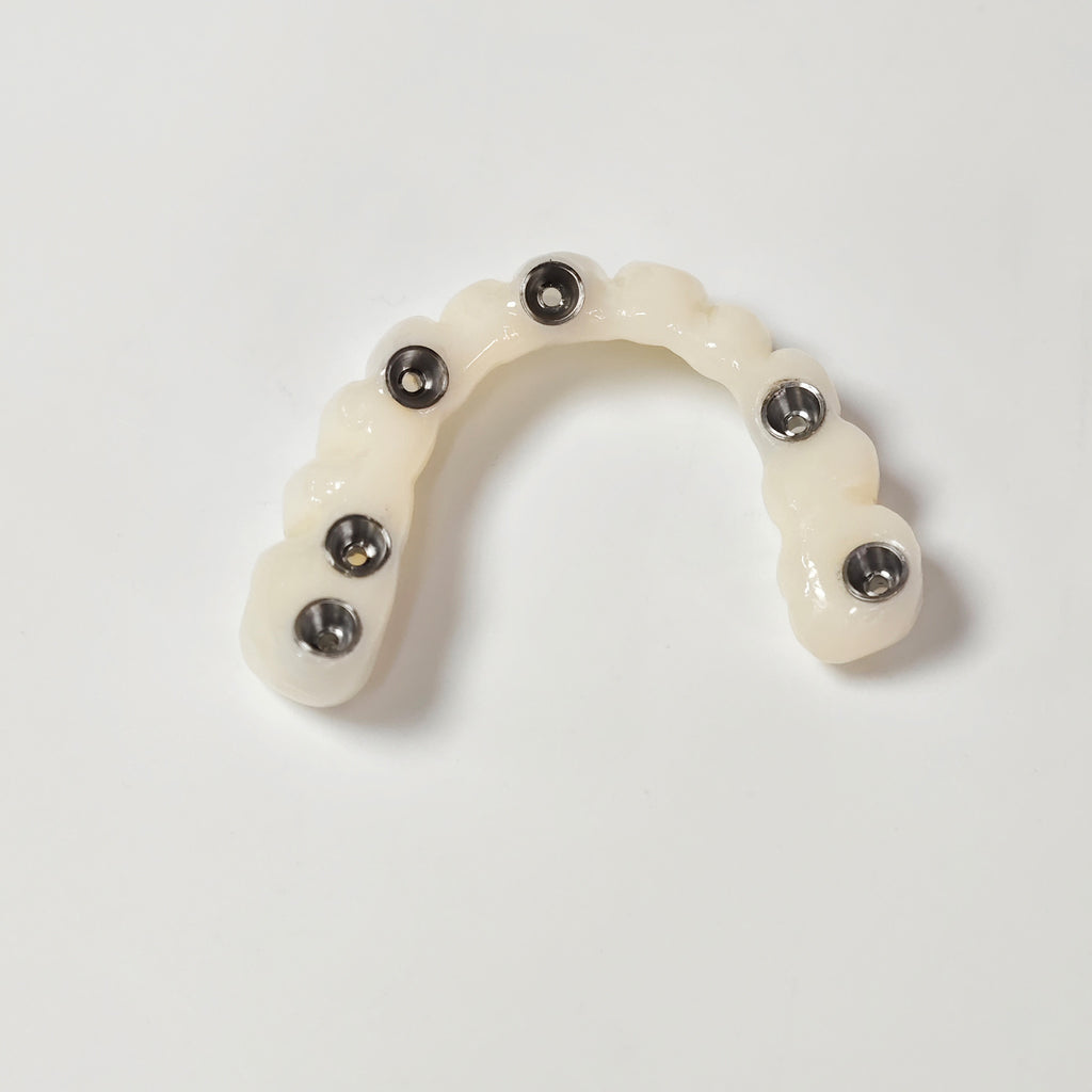 PMMA Bridge With Screw Retained