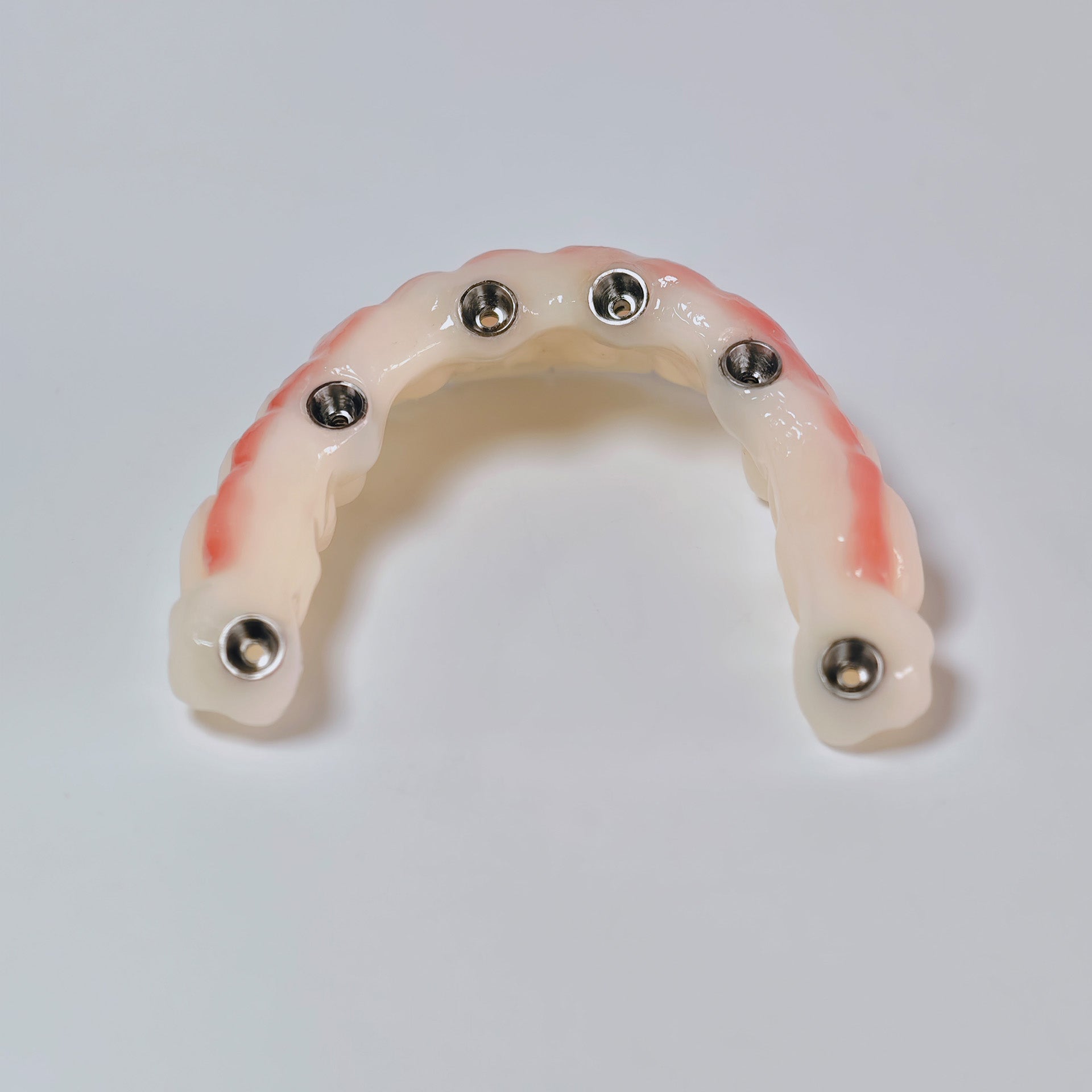 PMMA Bridge With Screw Retained