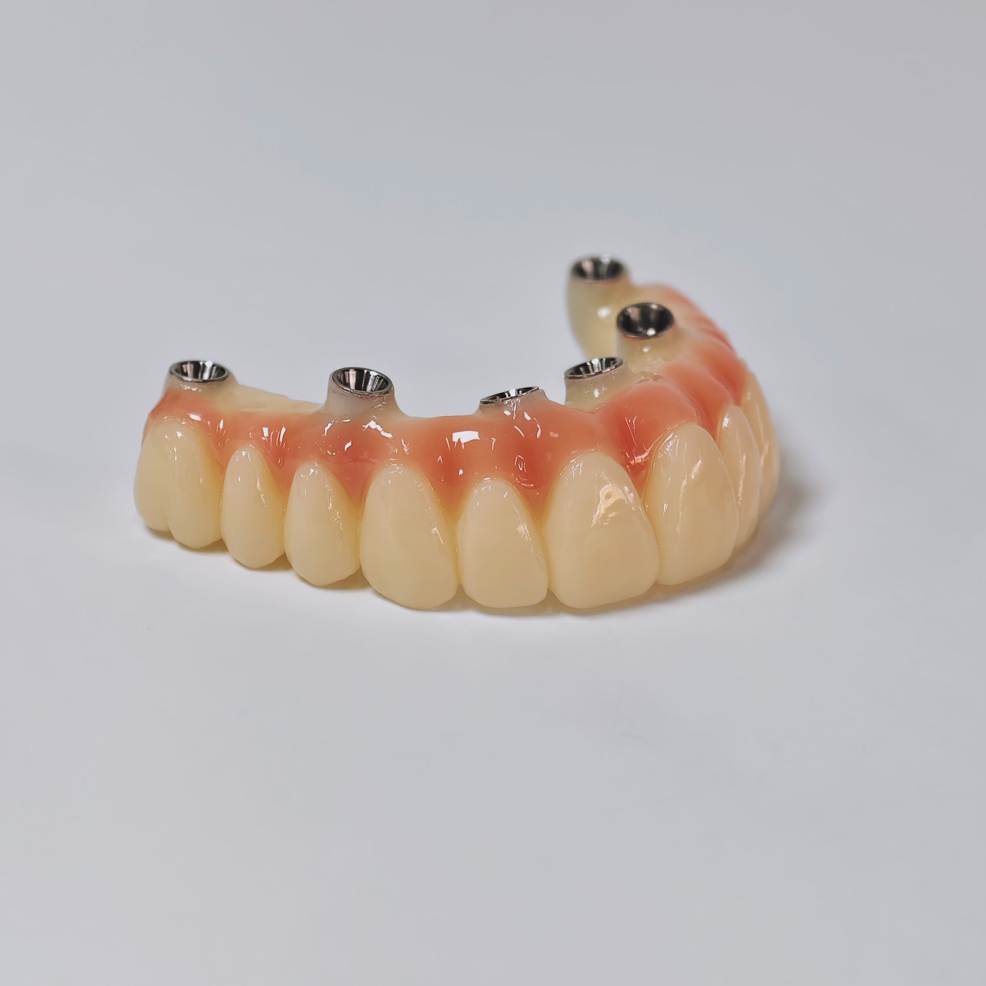 PMMA Bridge With Screw Retained