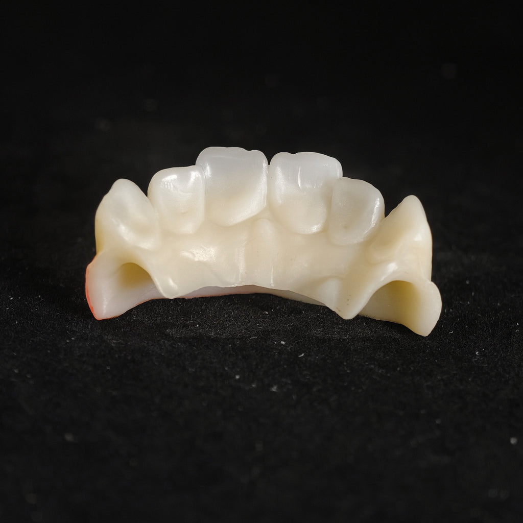 Ti-Bar Pure Titanium Metal Frame With Zirconia Bridge