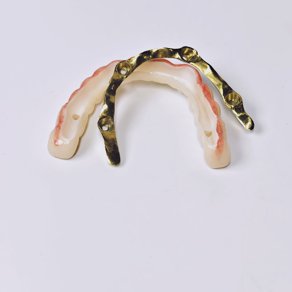 Ti-Bar Titanium Gold-Plated Metal Frame With Zirconia Bridge And Screw Retained