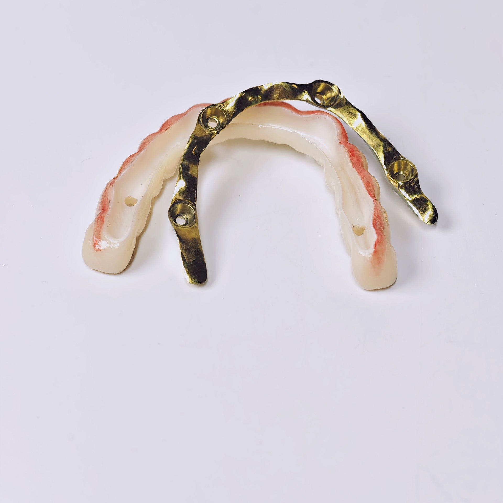 Ti-Bar Titanium Gold-Plated Metal Frame With Zirconia Bridge And Screw Retained