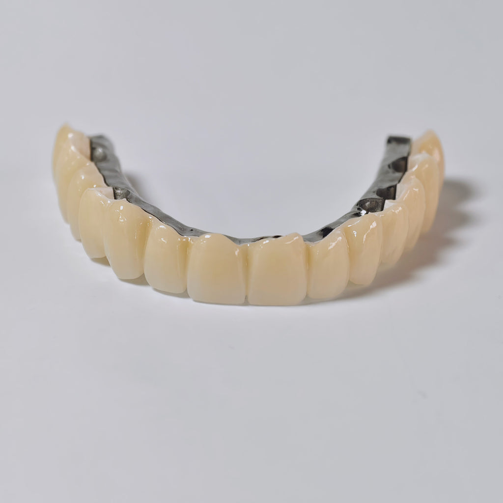 Ti-Bar Titanium Nitride Metal Frame With Zirconia Bridge And Cement Retained