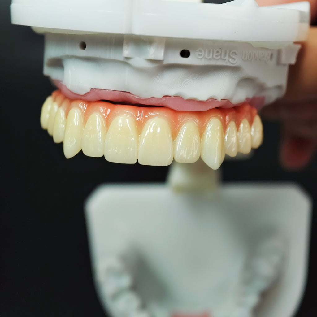 Ti-Bar Titanium Nitride Metal Frame With Zirconia Bridge For Full Arch Restoration