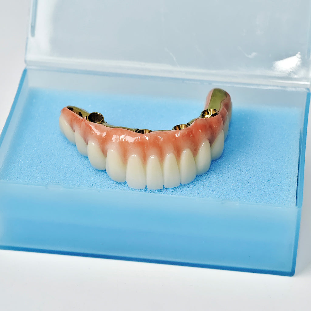 Ti-Bar Titanium Nitride Metal Frame With Zirconia Bridge For Full Arch Restoration