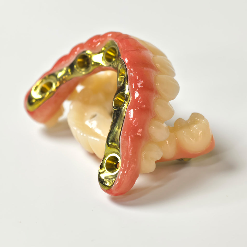 Ti-Bar Titanium Nitride Metal Frame With Zirconia Bridge For Full Arch Restoration