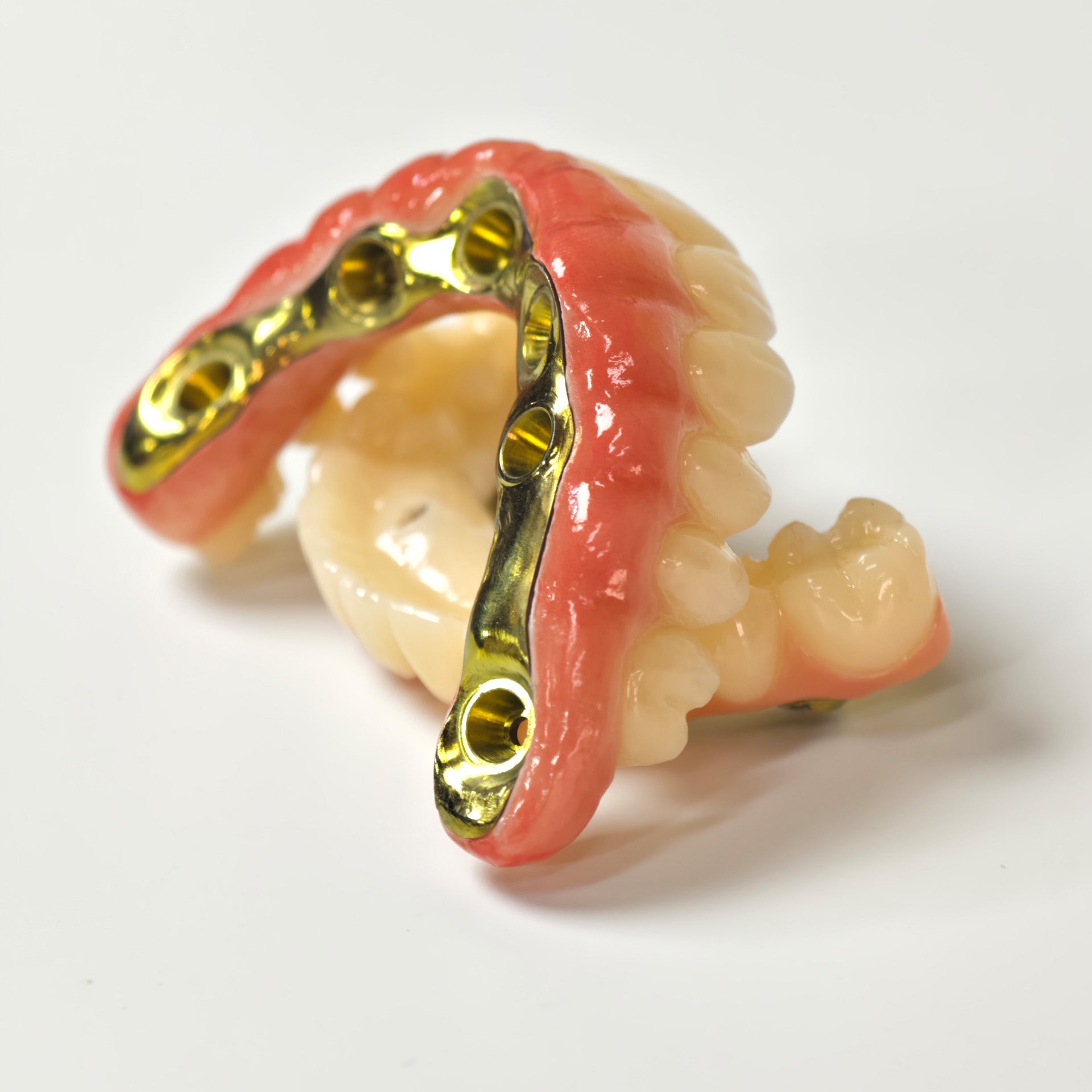 Ti-Bar Titanium Nitride Metal Frame With Zirconia Bridge For Full Arch Restoration