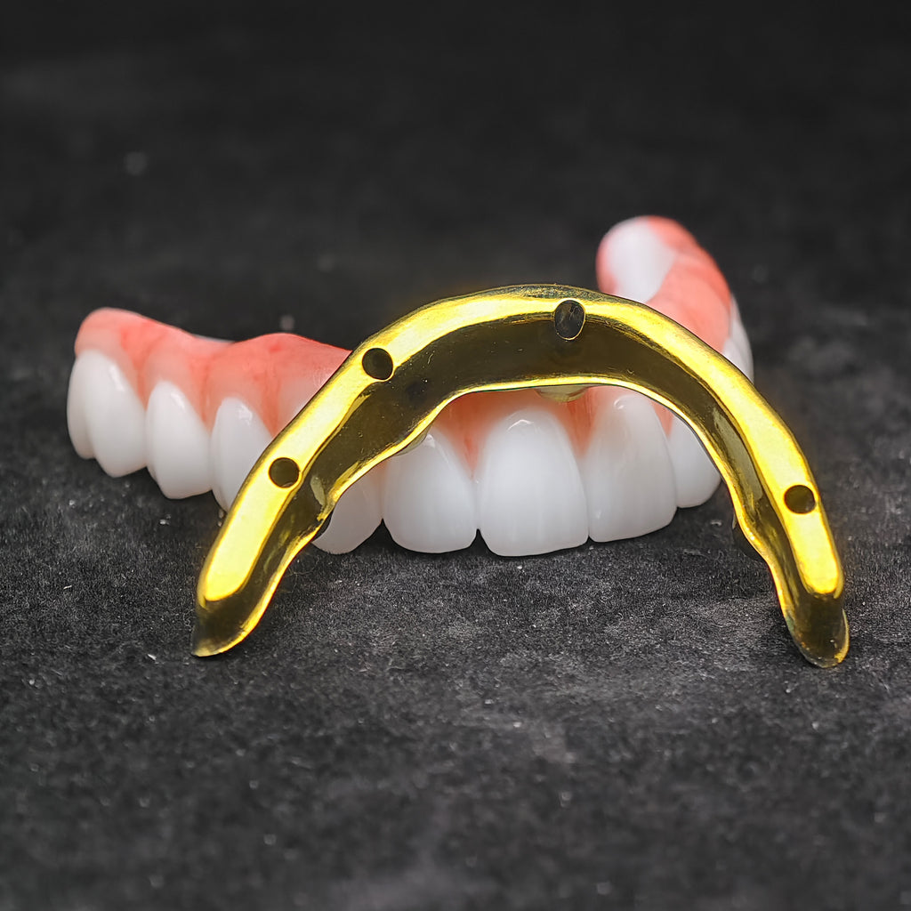 Ti-Bar Titanium Nitride Metal Frame With Zirconia Bridge For Full Arch Restoration