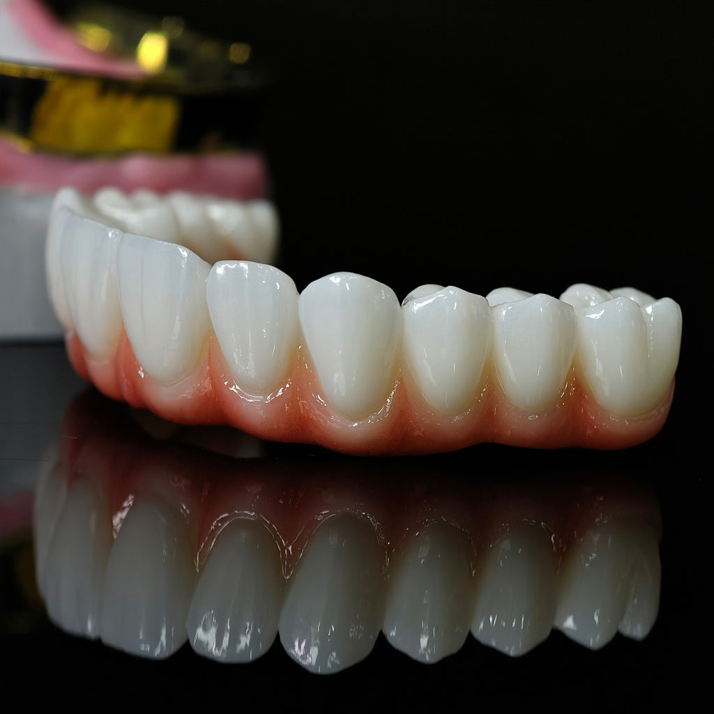Ti-Bar Titanium Nitride Metal Frame With Zirconia Bridge For Full Arch Restoration