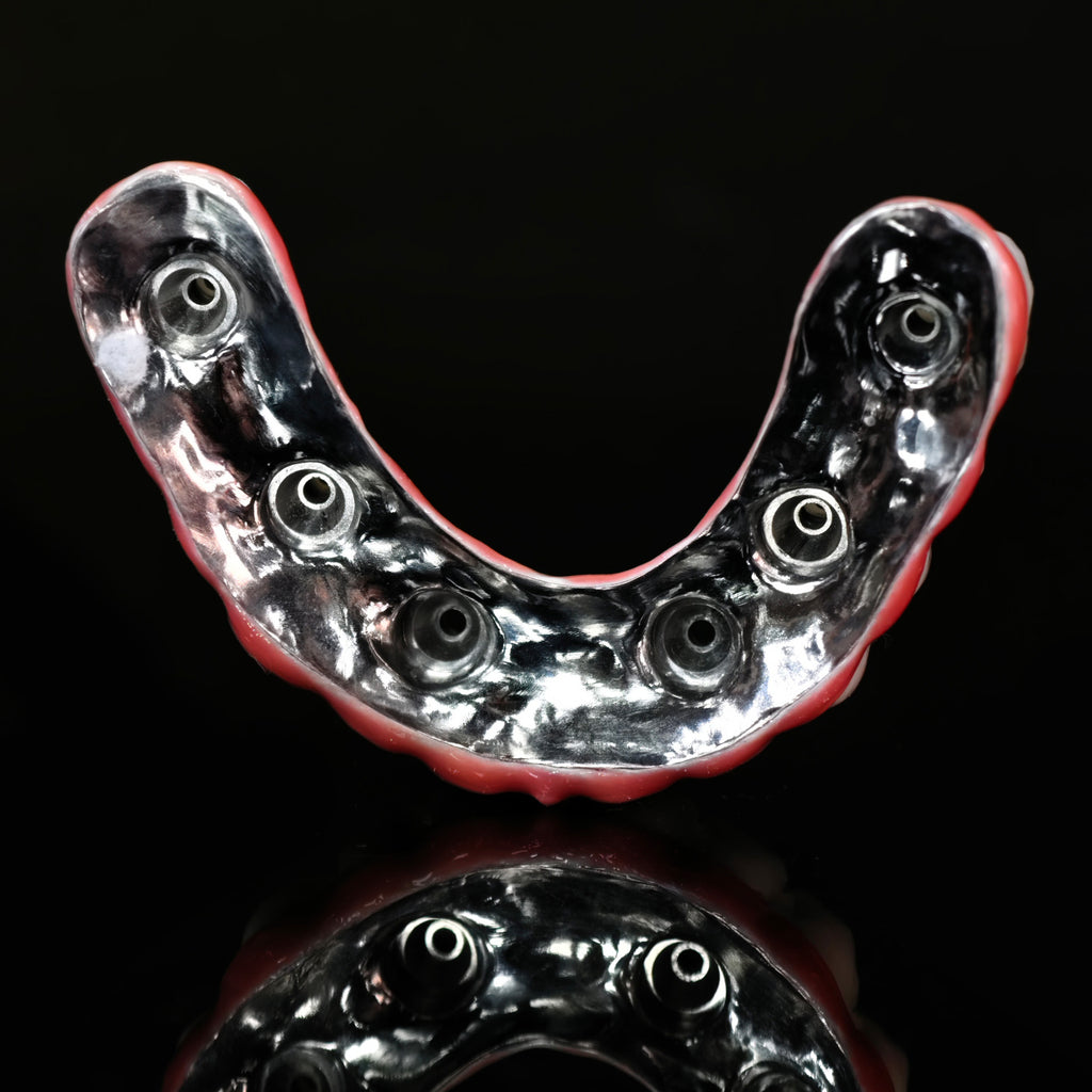Traditional Malo Bridge With Alloy Framework Covering The Gingiva