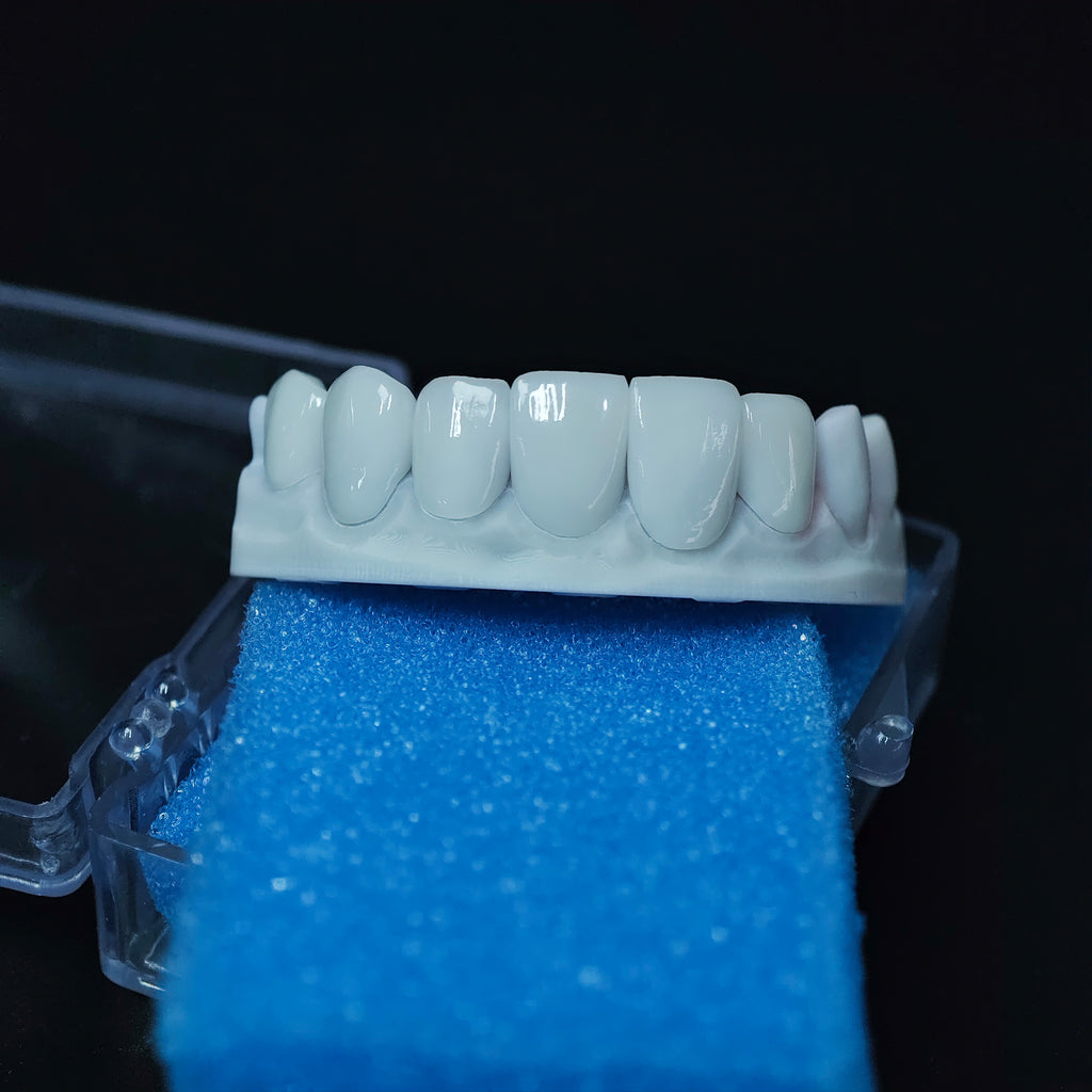 Ultra-Thin Emax Veneer. High Transparency/Translucent, Natural Shade