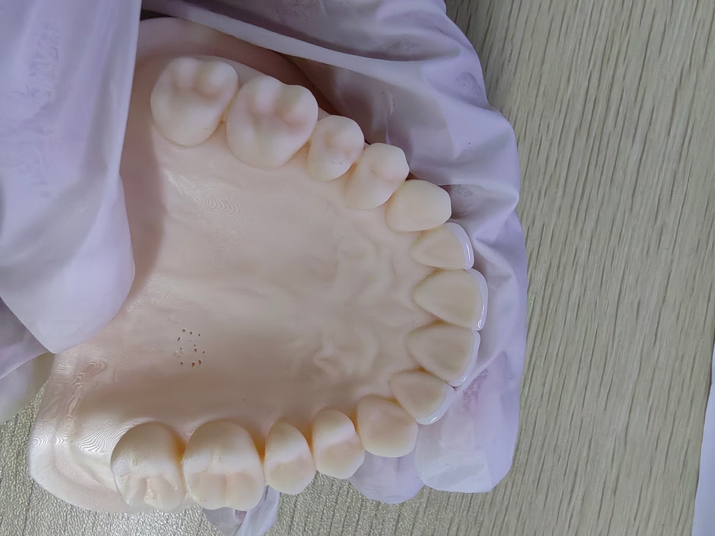 Ultra-Thin Emax Veneer. High Transparency/Translucent, Natural Shade