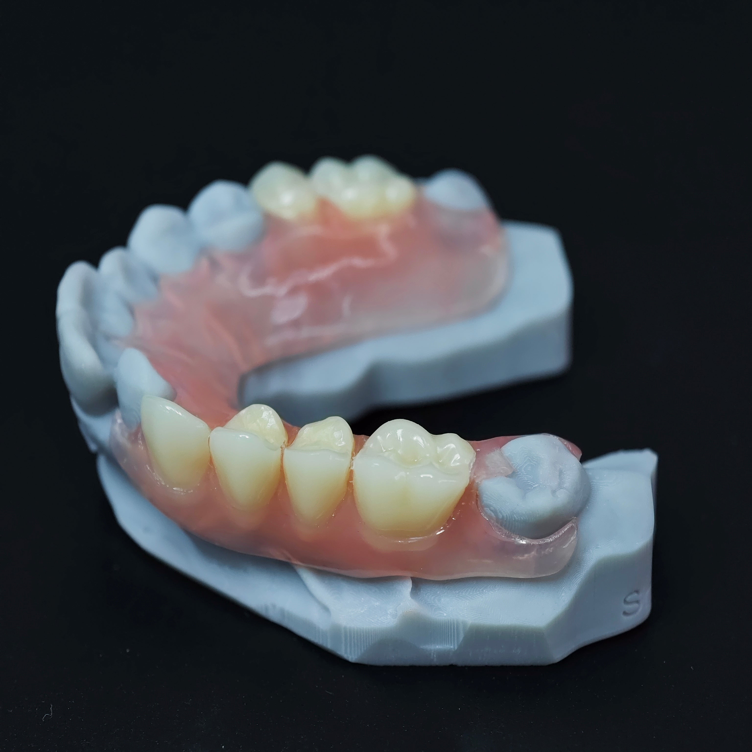 Valplast Denture Beautiful And Elastic Flexible Partial Natural Appearance