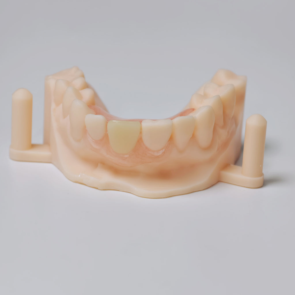 Valplast Denture Beautiful And Elastic Flexible Partial Natural Appearance