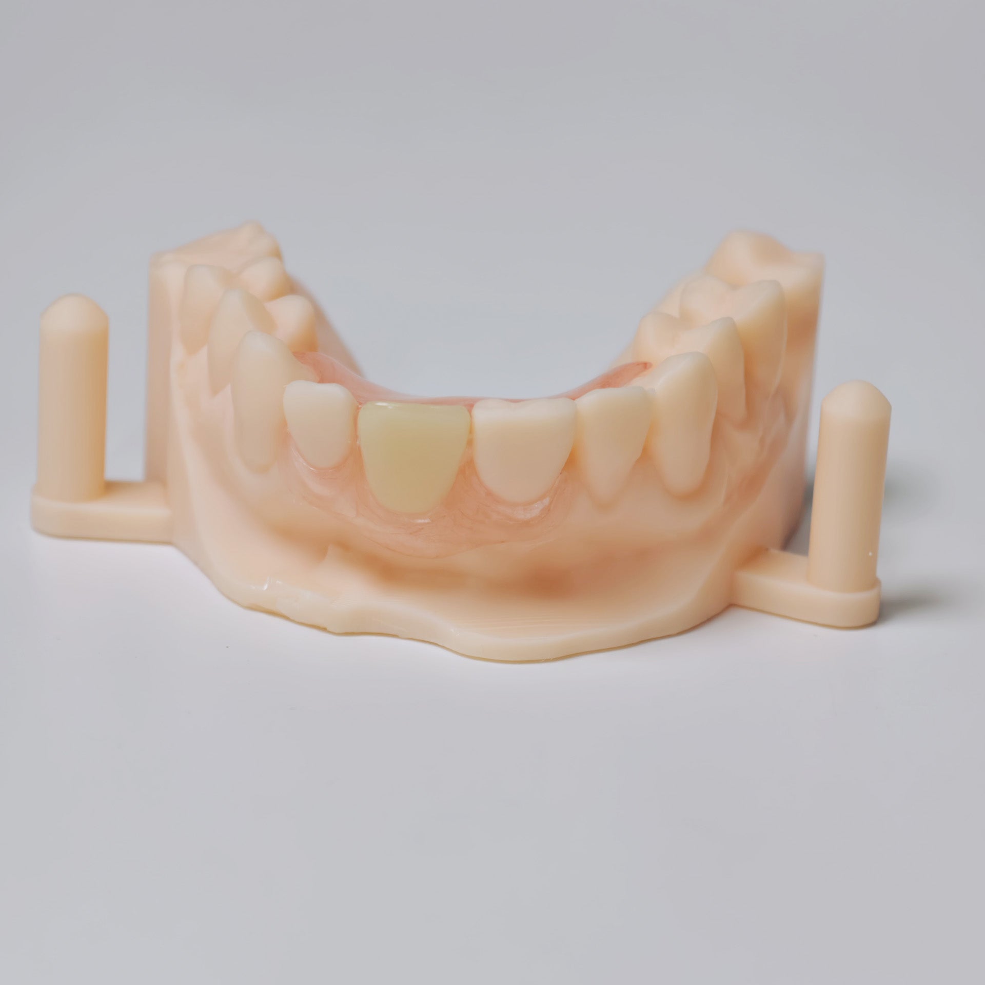 Valplast Denture Beautiful And Elastic Flexible Partial Natural Appearance