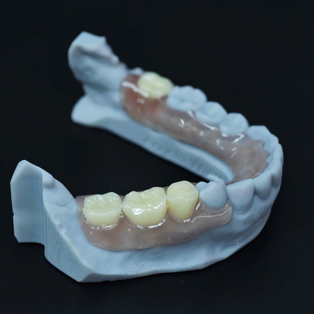 Valplast Denture Beautiful And Elastic Flexible Partial Natural Appearance
