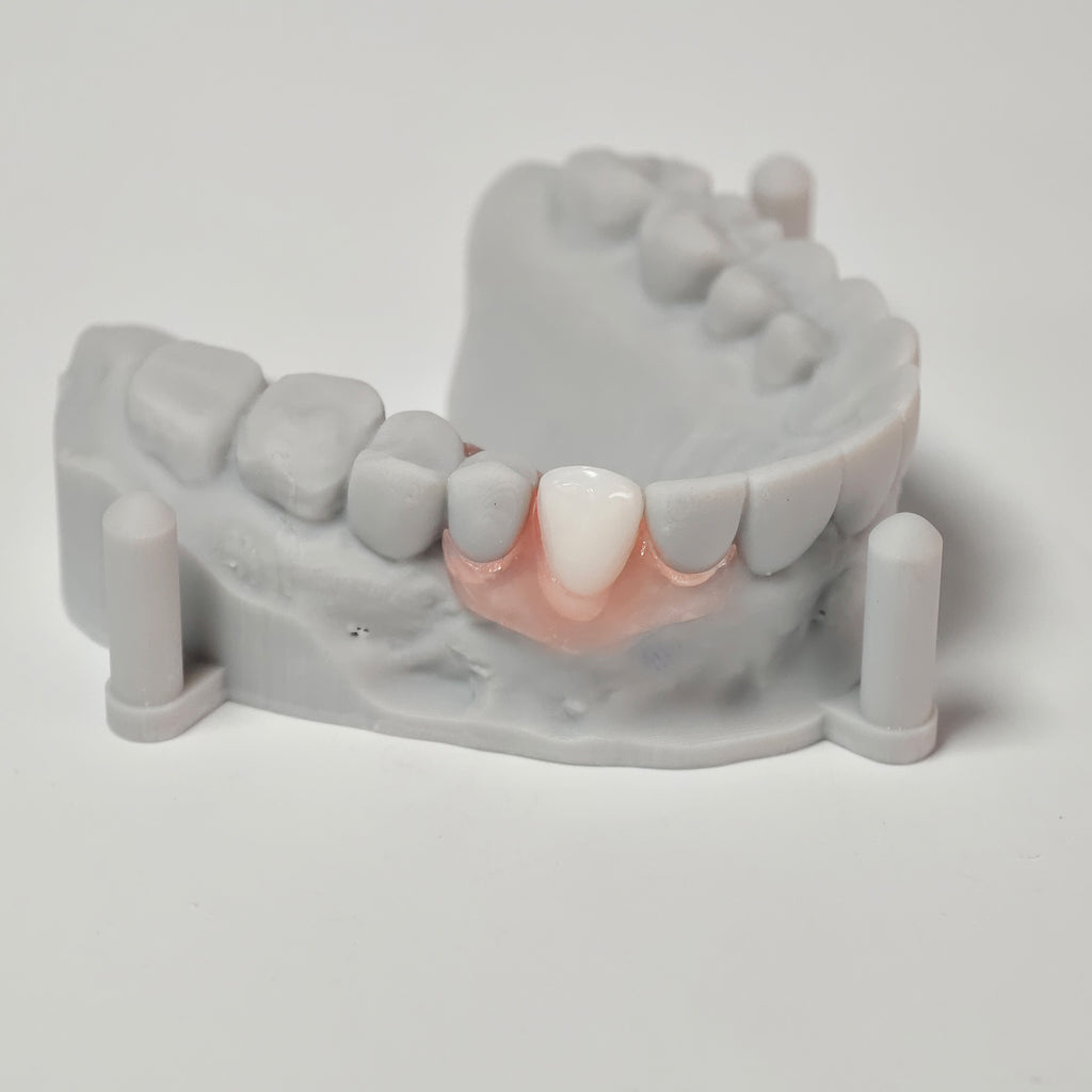 Valplast Denture Beautiful And Elastic Flexible Partial Natural Appearance