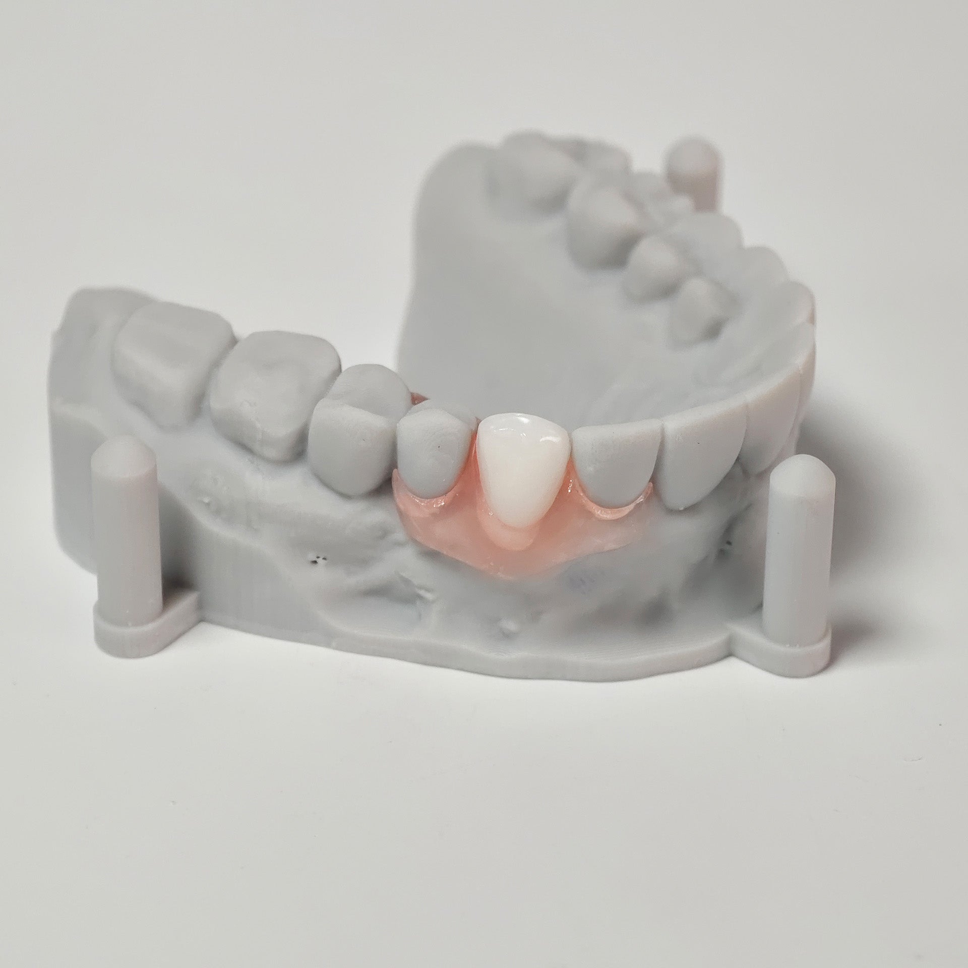 Valplast Denture Beautiful And Elastic Flexible Partial Natural Appearance