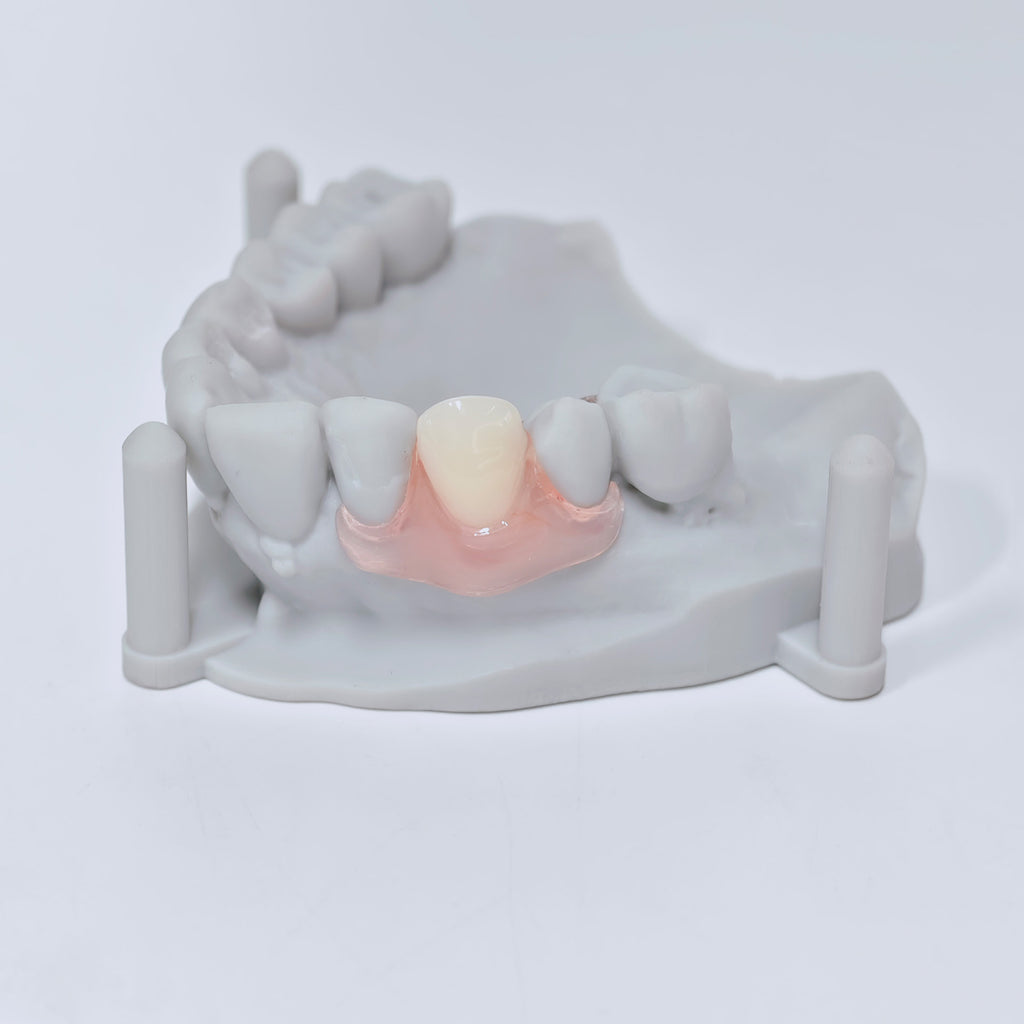 Valplast Denture Beautiful And Elastic Flexible Partial Natural Appearance