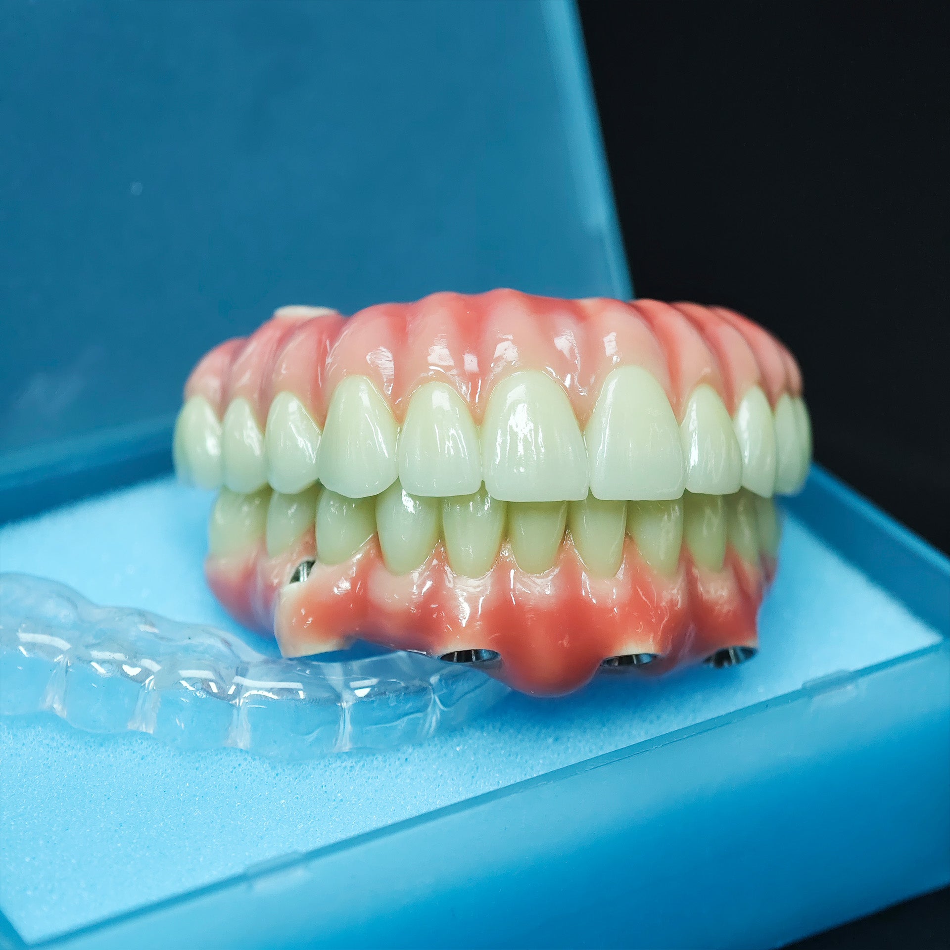 Zirconia-Enamel Hybrid Malo Bridge