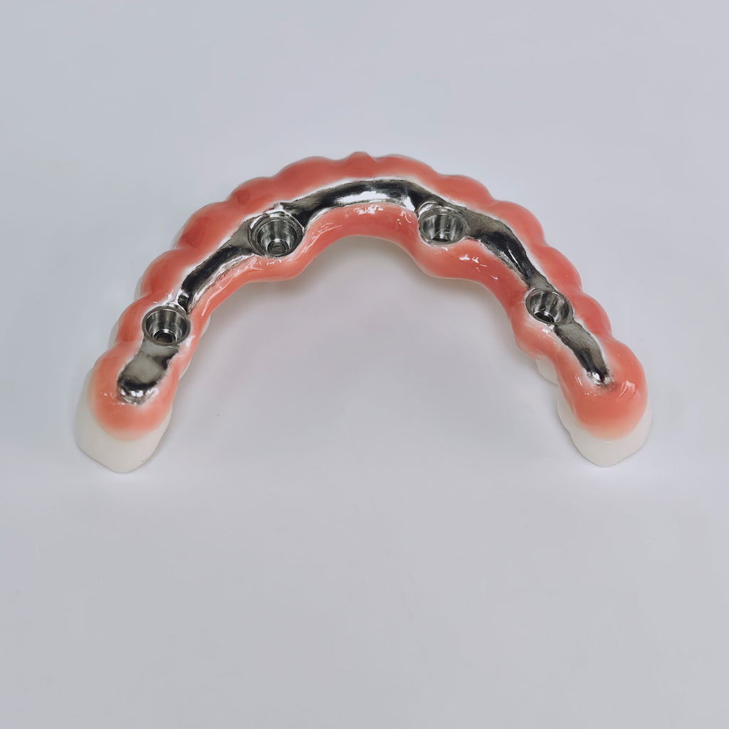 Zirconia-Enamel Hybrid Malo Bridge Aesthetic
