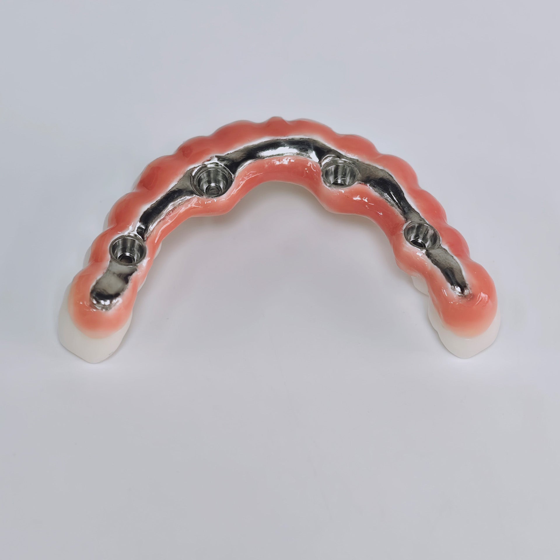 Zirconia-Enamel Hybrid Malo Bridge Aesthetic
