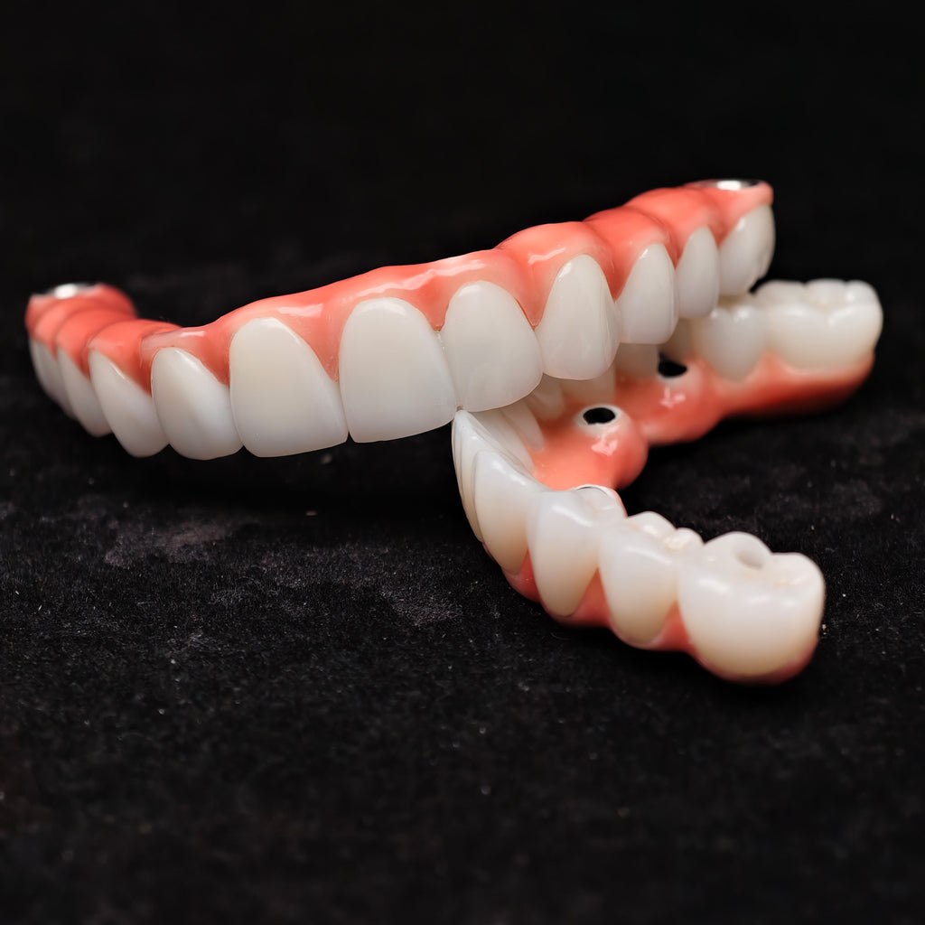 Zirconia-Enamel Hybrid Malo Bridge