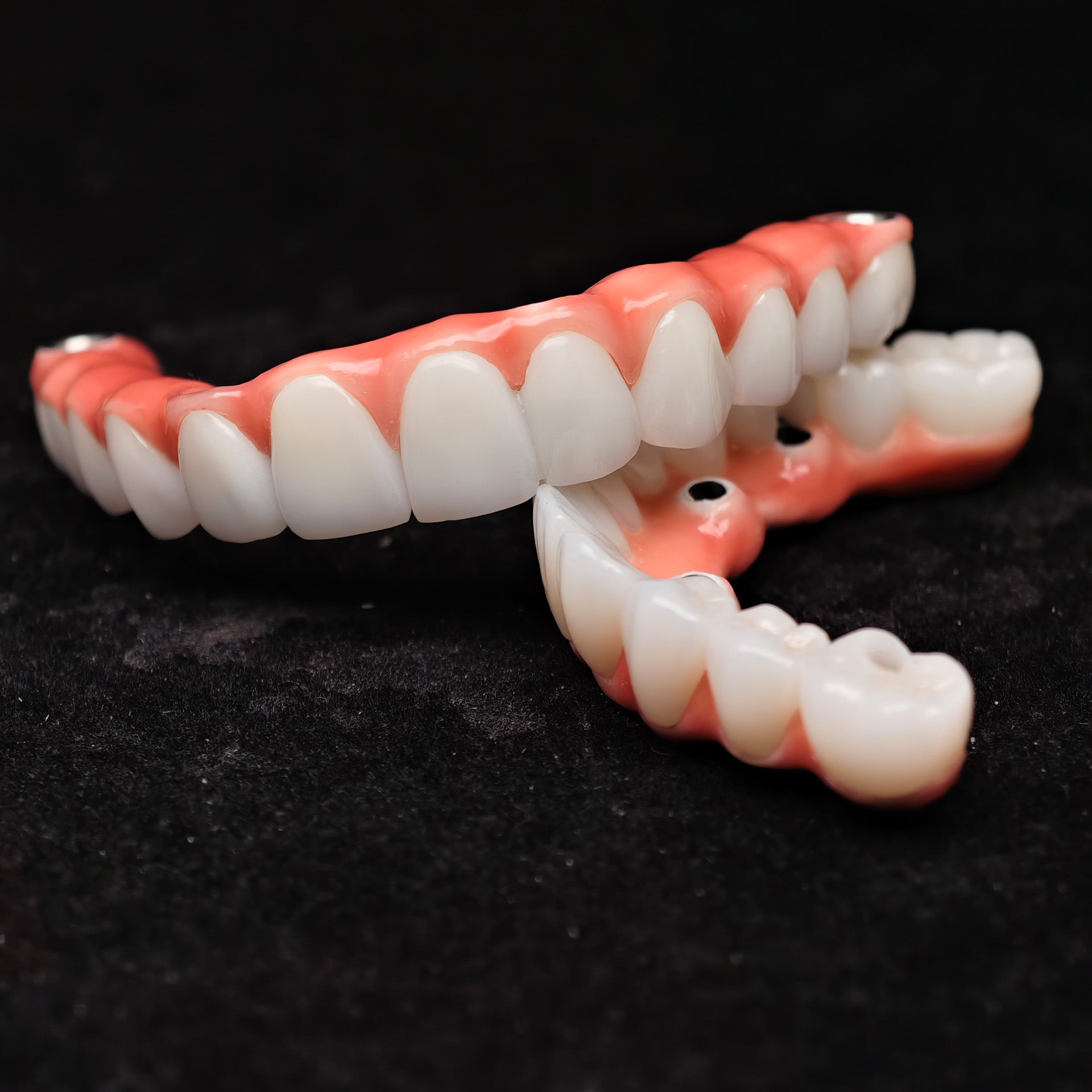 Zirconia-Enamel Hybrid Malo Bridge