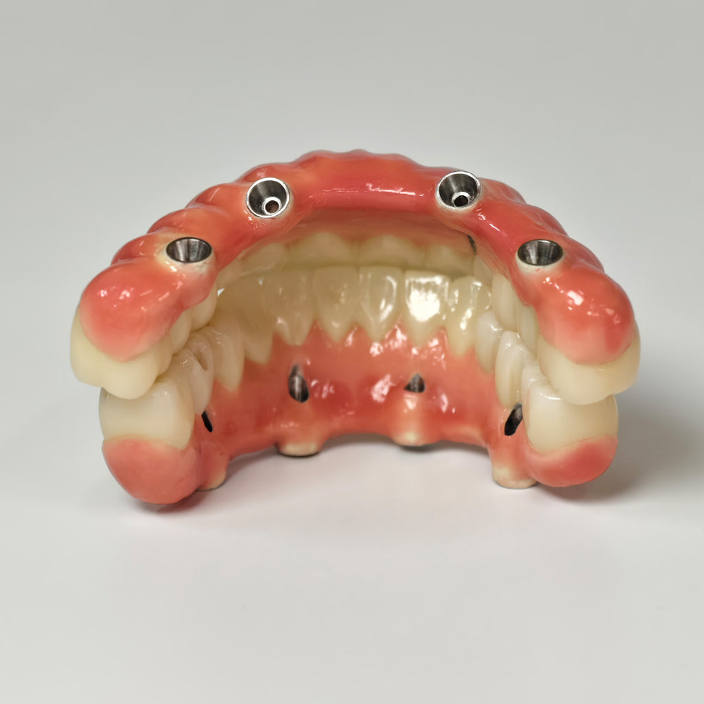 Zirconia-Enamel Hybrid Malo Bridge