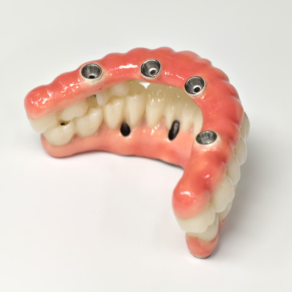 Zirconia-Enamel Hybrid Malo Bridge