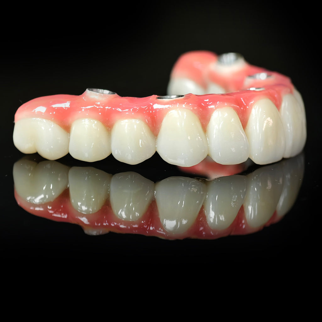 Zirconia-Enamel Hybrid Malo Bridge