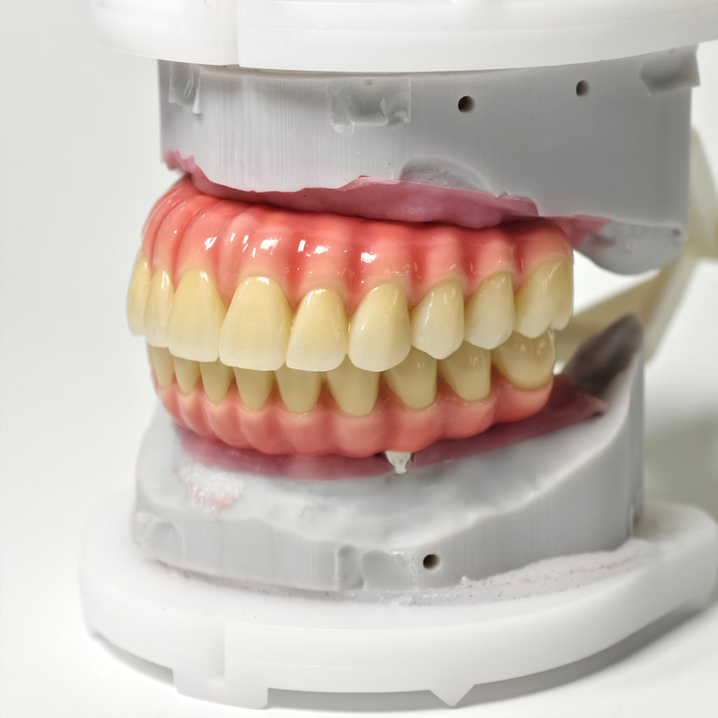 Zirconia-Enamel Hybrid Malo Bridge