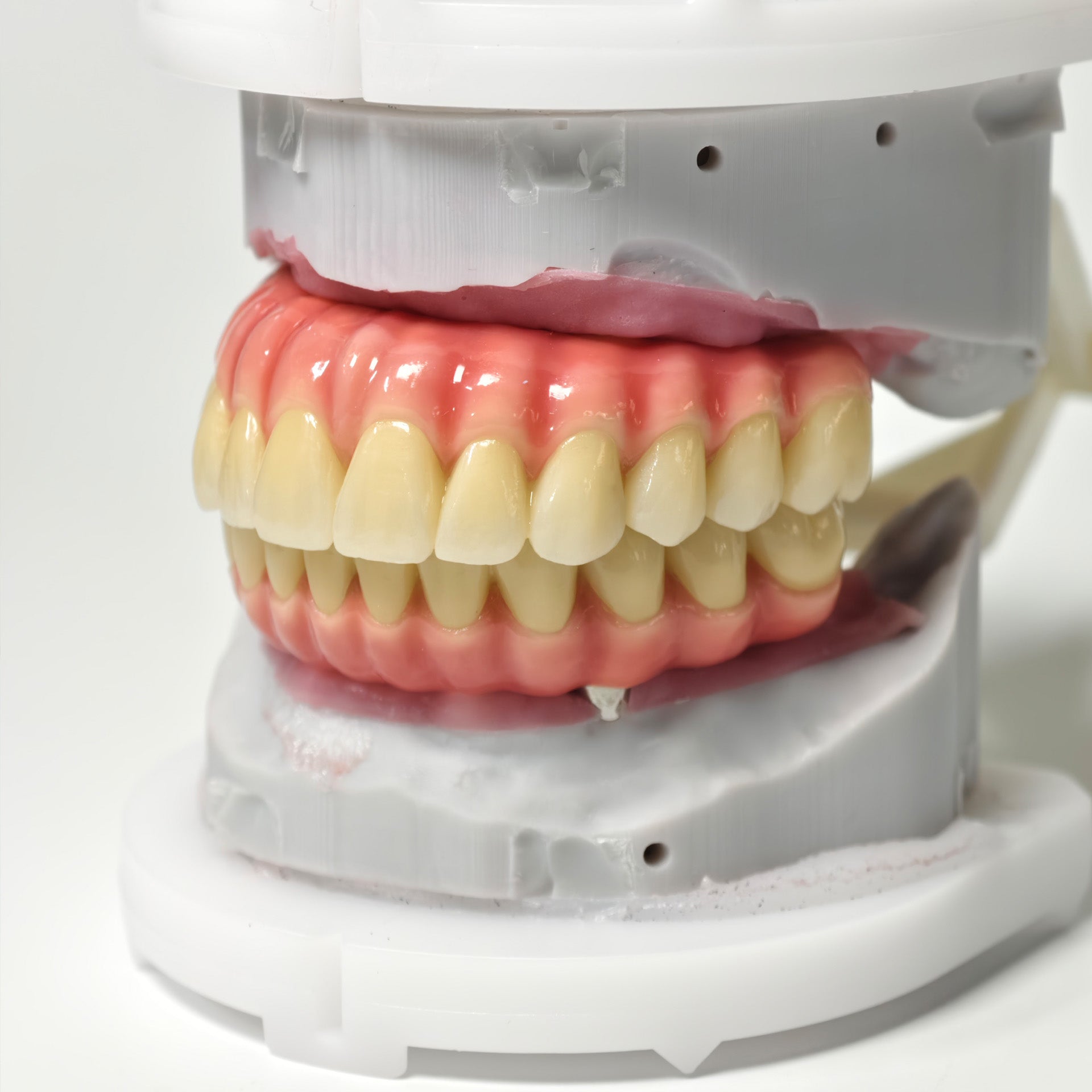 Zirconia-Enamel Hybrid Malo Bridge