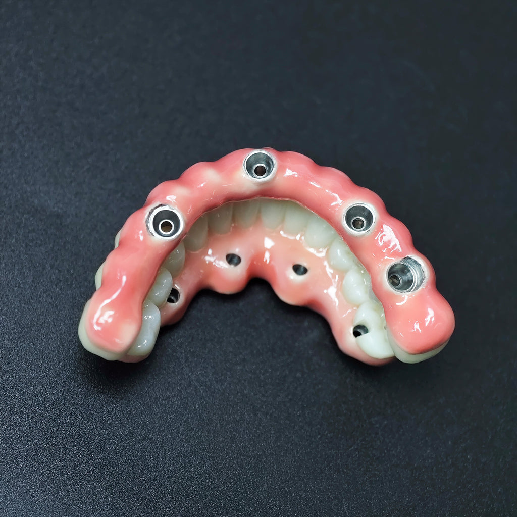 Zirconia-Enamel Hybrid Malo Bridge
