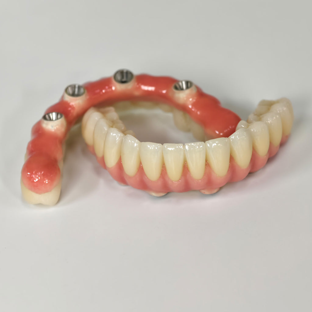 Zirconia-Enamel Hybrid Malo Bridge