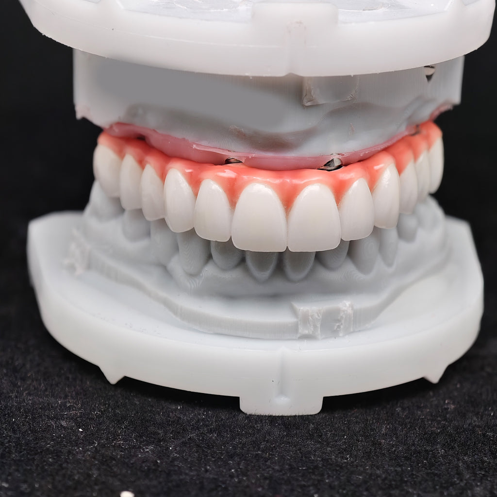 Zirconia-Enamel Hybrid Malo Bridge