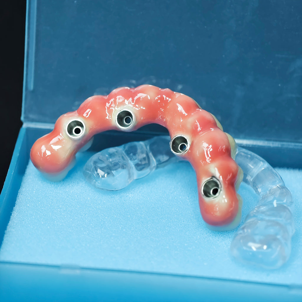 Zirconia-Enamel Hybrid Malo Bridge