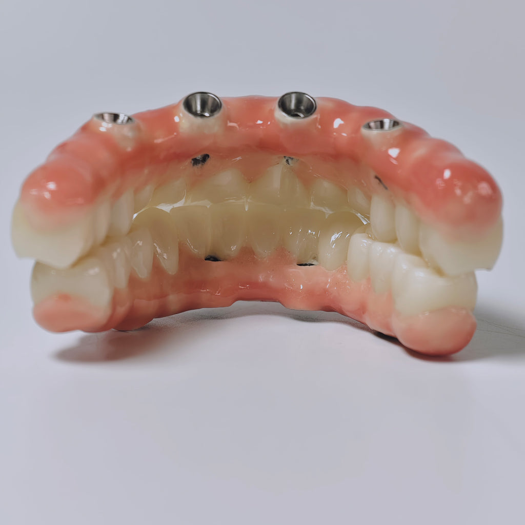Zirconia-Enamel Hybrid Malo Bridge