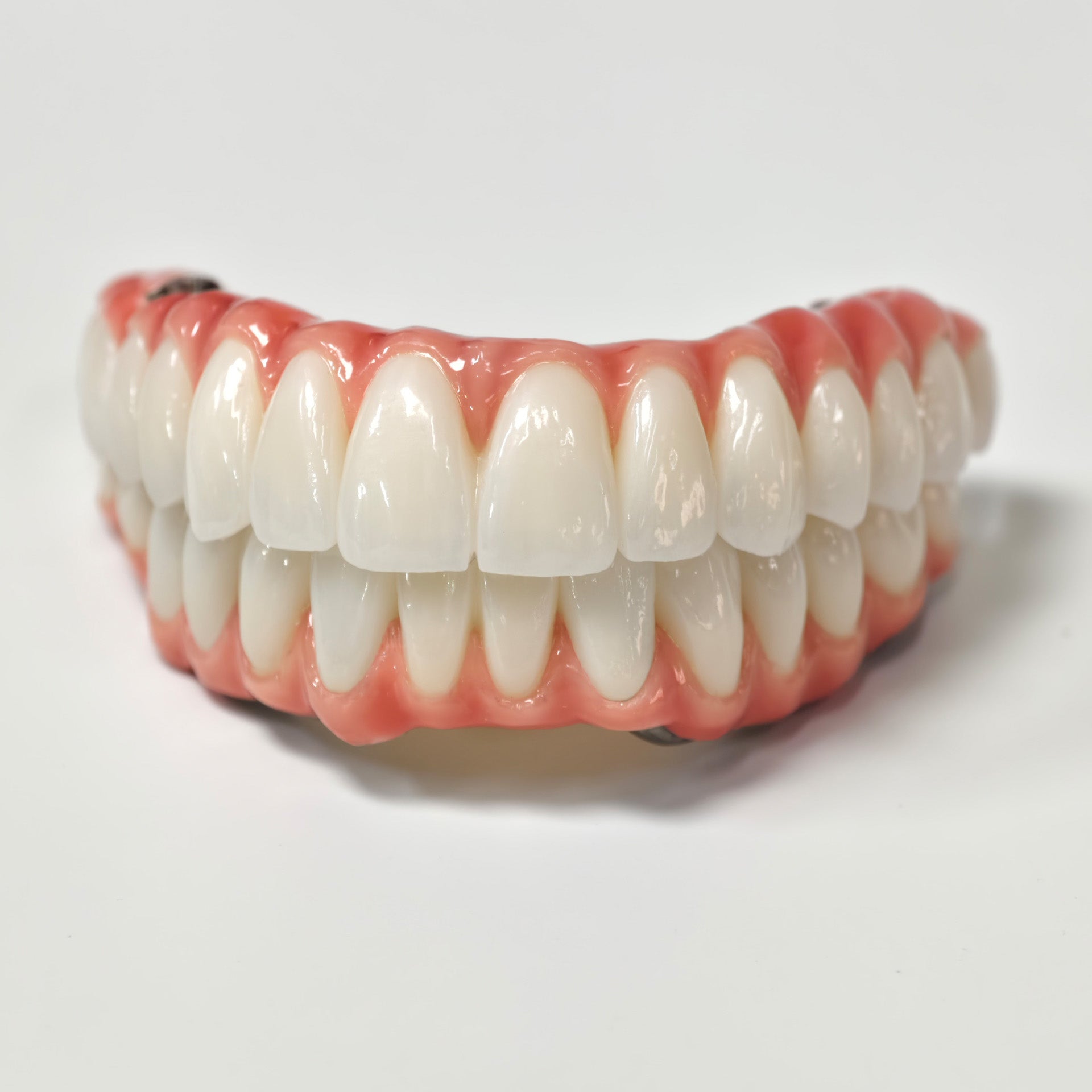 Zirconia-Enamel Hybrid Malo Bridge