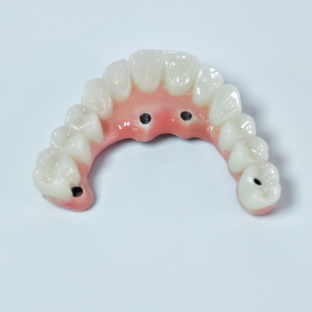 Zirconia-Enamel Hybrid Malo Bridge