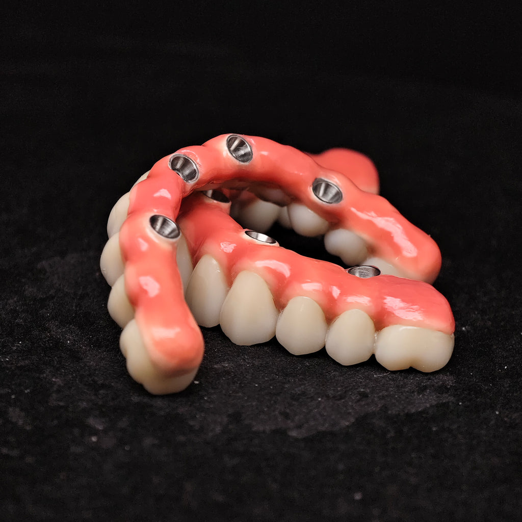 Zirconia-Enamel Hybrid Malo Bridge