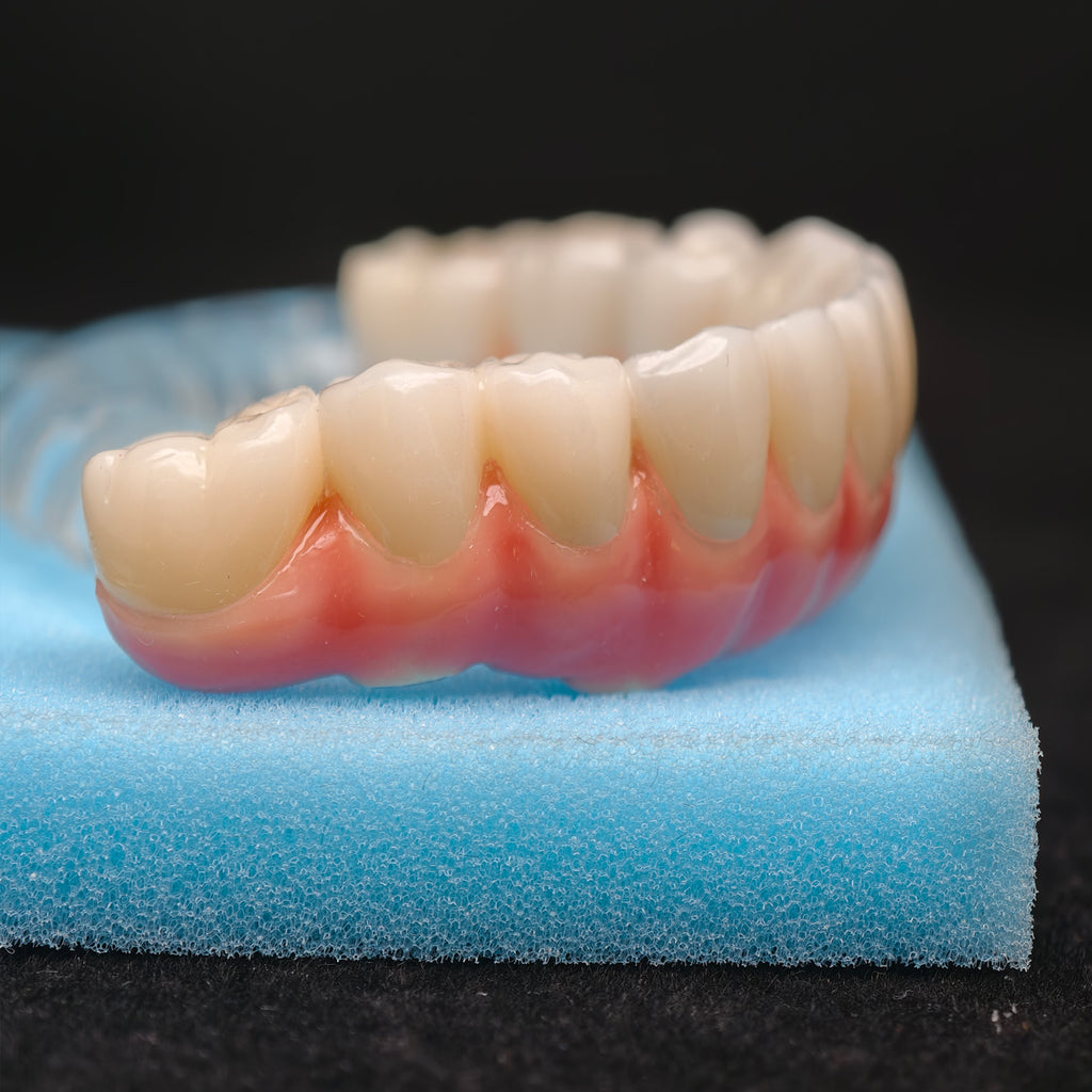 Zirconia-Enamel Hybrid Malo Bridge