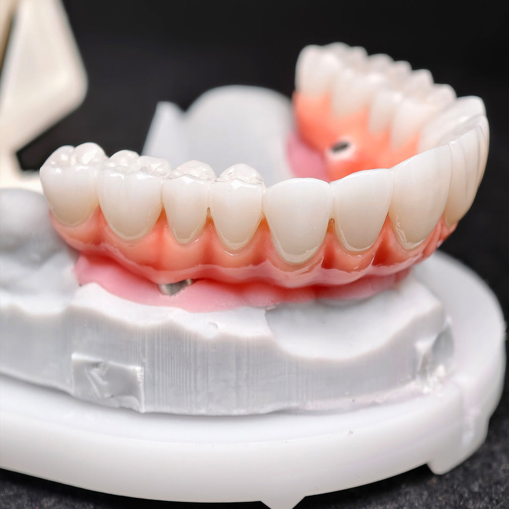 Zirconia-Enamel Hybrid Malo Bridge